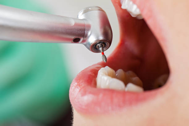 Best Emergency Treatment for Toothache in Montclair, CA